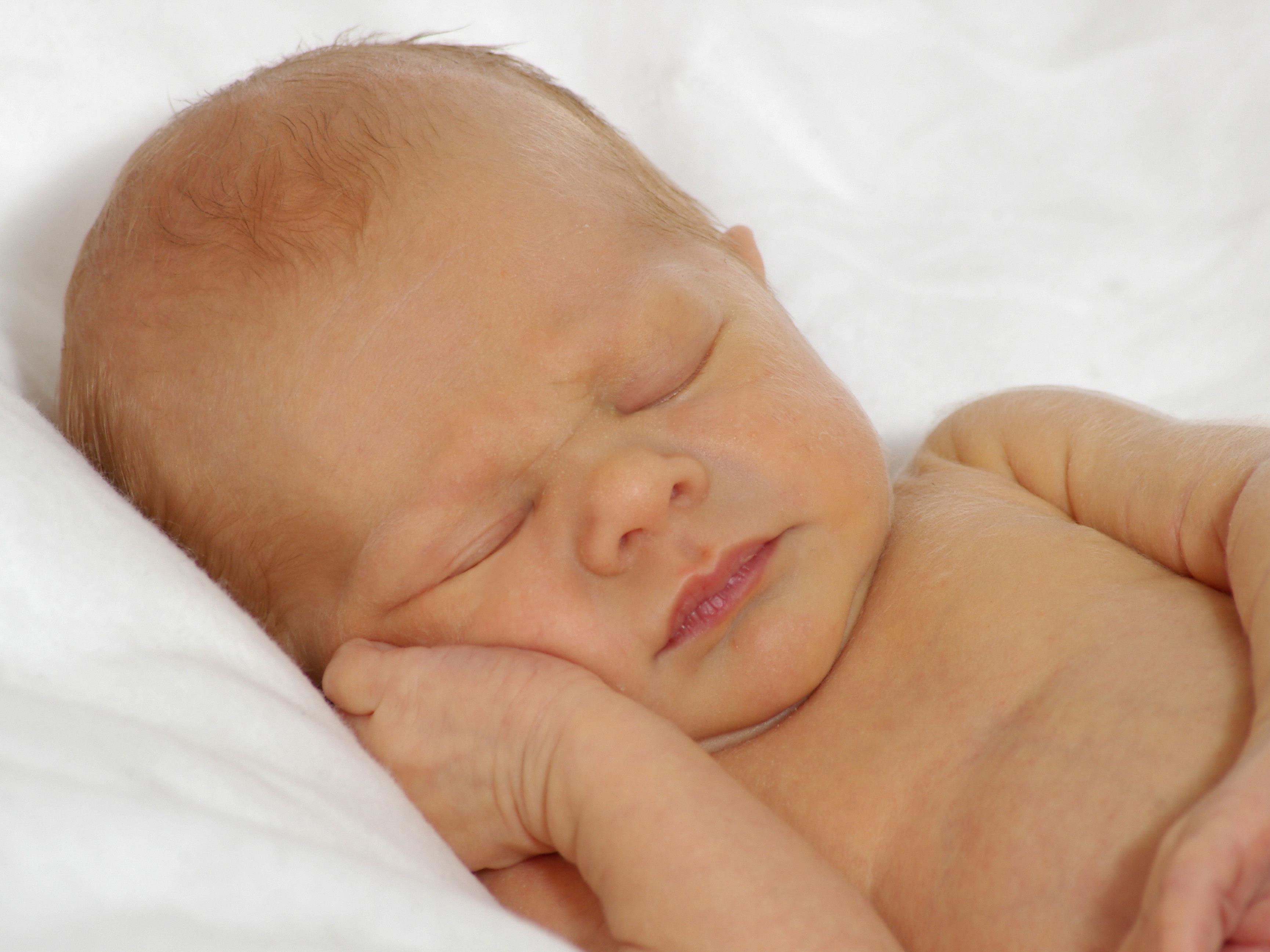 Желтушка у новорожденных отзывы. Желтушка у новорожденных. Физиологическая желтуха новорожденных.