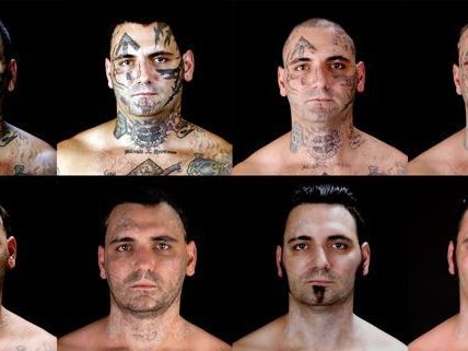 Bryon Widner ließ sich in schmerzhaften Sitzungen seine Nazi-Tattoos entfernen. Bryon Widner ließ sich in schmerzhaften Sitzungen seine Nazi-Tattoos entfernen.