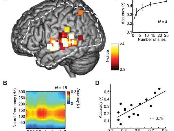 Tests mit 15 Probanden - Hoffnung auf Hilfe für Schlaganfall-Patienten Tests mit 15 Probanden - Hoffnung auf Hilfe für Schlaganfall-Patienten