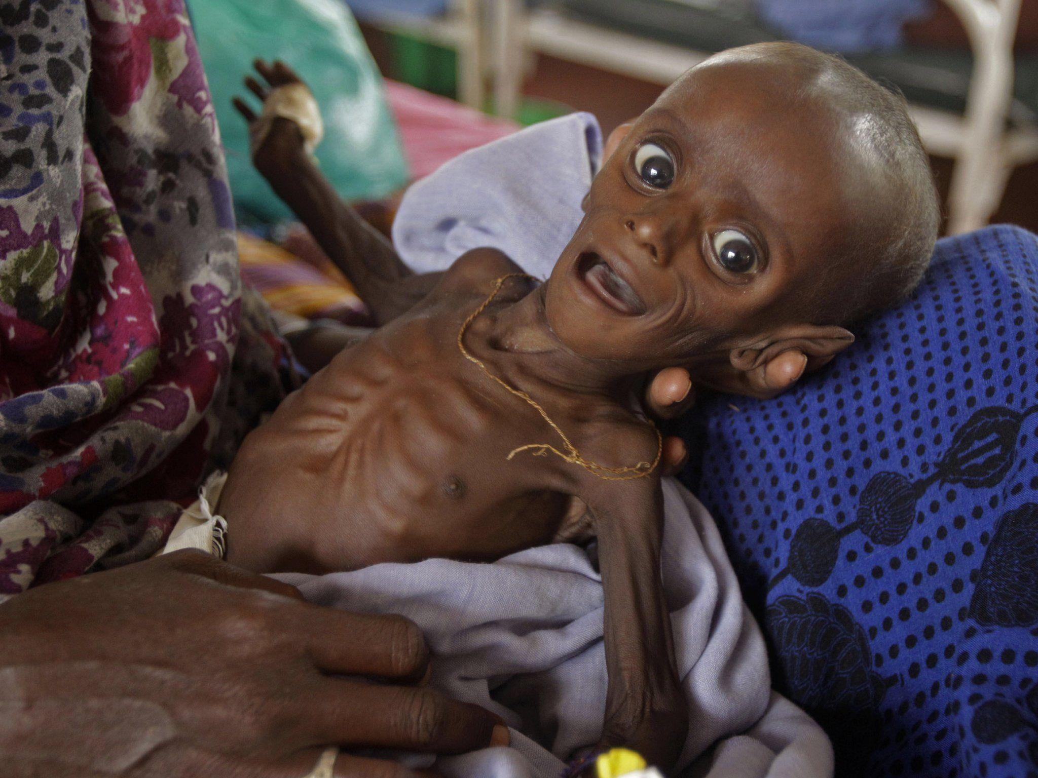 Die Hungerkatastrophe in der Sahelzone: Vor allem Kinder sind notleidend.
