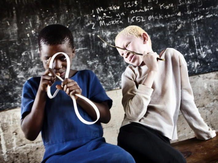 Symbolbild: Das Unicef-Foto des Jahres 2009 zeigt Selina, eine der rund 150.000 Albinos in Tanzania.