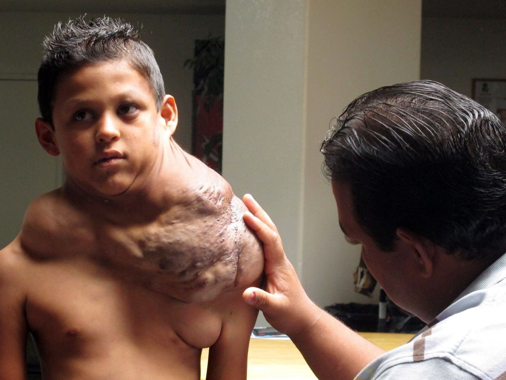 Der neunjährige José leidet an einem riesigen Tumor. Der neunjährige José leidet an einem riesigen Tumor.