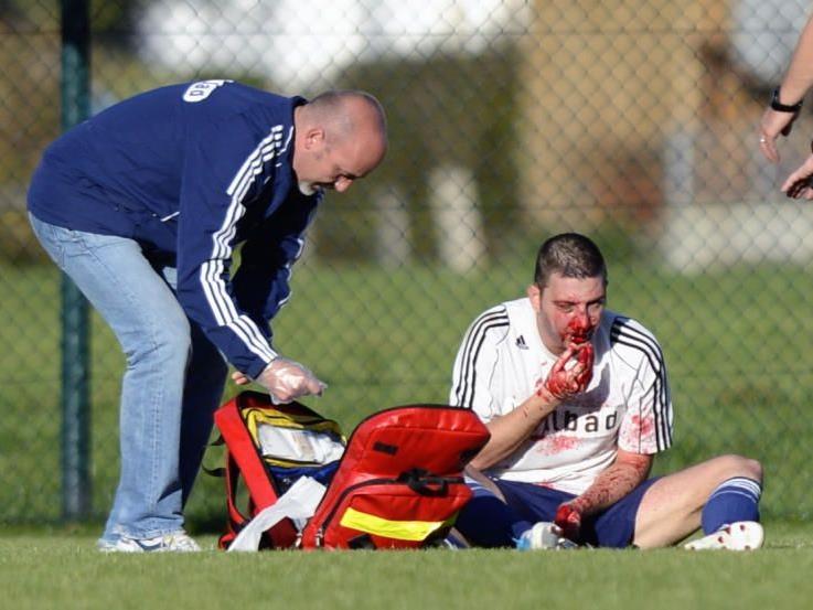 FC Götzis Torjäger Nenad Krstic erlitt schwerste Kopfverletzungen aber wieder auf dem Weg der Besserung.