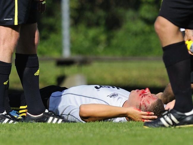 Höchst-Spieler Marcel Wirth arbeitet fieberhaft an seinem Comeback, aber er hat immer noch Schmerzen. Höchst-Spieler Marcel Wirth arbeitet fieberhaft an seinem Comeback, aber er hat immer noch Schmerzen.