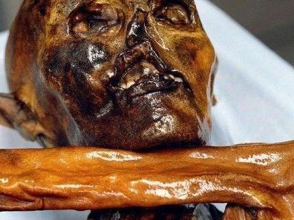 Die Darmflora von Ötzi ähnelt heute am ehesten der von ländlich lebenden, afrikanischen Kindern. Die Darmflora von Ötzi ähnelt heute am ehesten der von ländlich lebenden, afrikanischen Kindern.
