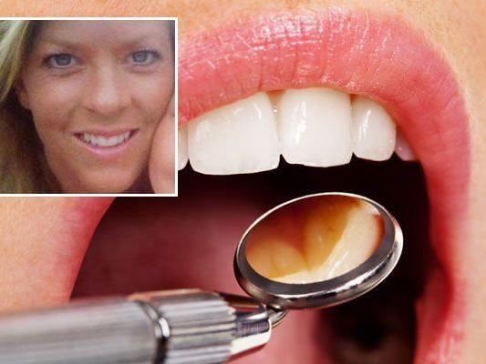 Zahnarzt feuert attraktive Assistentin: Gericht sieht keine Diskriminierung.