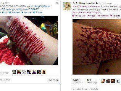 "Fans" fügen sich ernsthafte Verletzungen zu, um gegen den vermeintlichen Drogenkonsum Biebers zu protestieren.