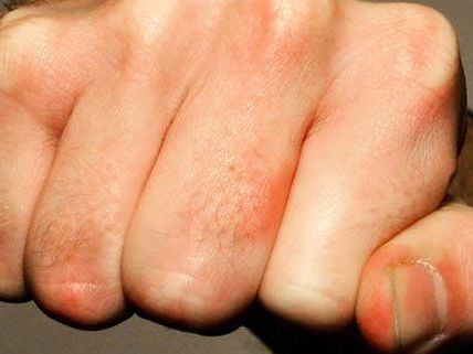 Am Sonntag wurde ein 25-Jähriger in Baden niedergeschlagen. Am Sonntag wurde ein 25-Jähriger in Baden niedergeschlagen.