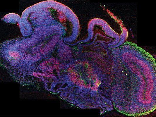 CI - Querschnitt eines zerebralen Organoids mit verschiedenen Gehirnregionen. Sichtbar sind die Zellen der Organkultur in den Farben blau, rot neuronale Stammzellen und grün Neuronen.