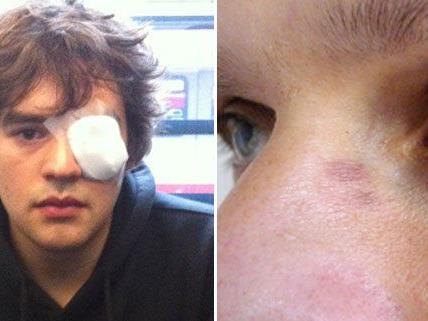 Ein Aktivist soll laut VGT schwere Verletzungen am Auge davon getragen haben (Bild links).