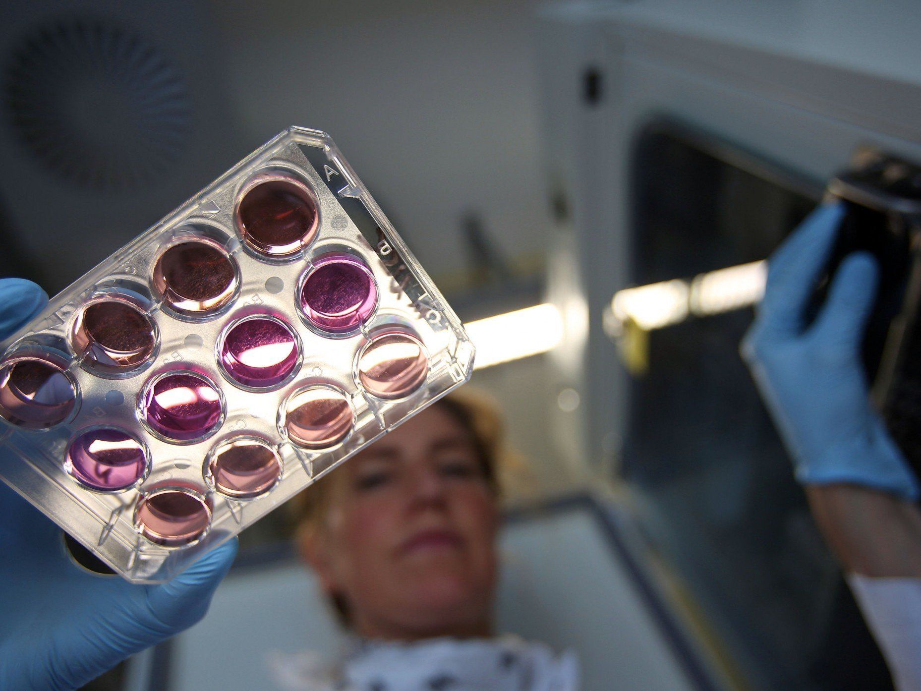 Forscher haben einen Weg gefunden den Unterschied zwischen einem Herzinfarkt und einem "gebrochenen Herzen" leichter nachzuweisen. Forscher haben einen Weg gefunden den Unterschied zwischen einem Herzinfarkt und einem "gebrochenen Herzen" leichter nachzuweisen.