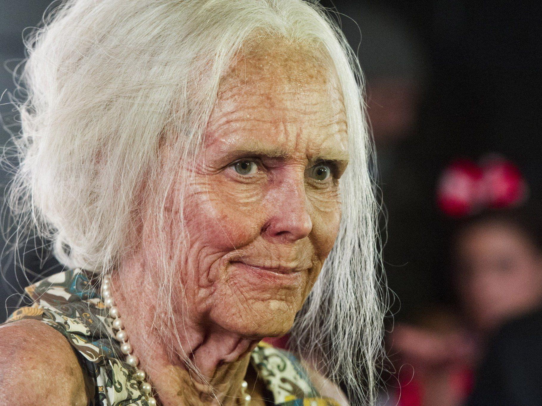 Heidi Klum mit Falten und Krampfadern. Heidi Klum mit Falten und Krampfadern.