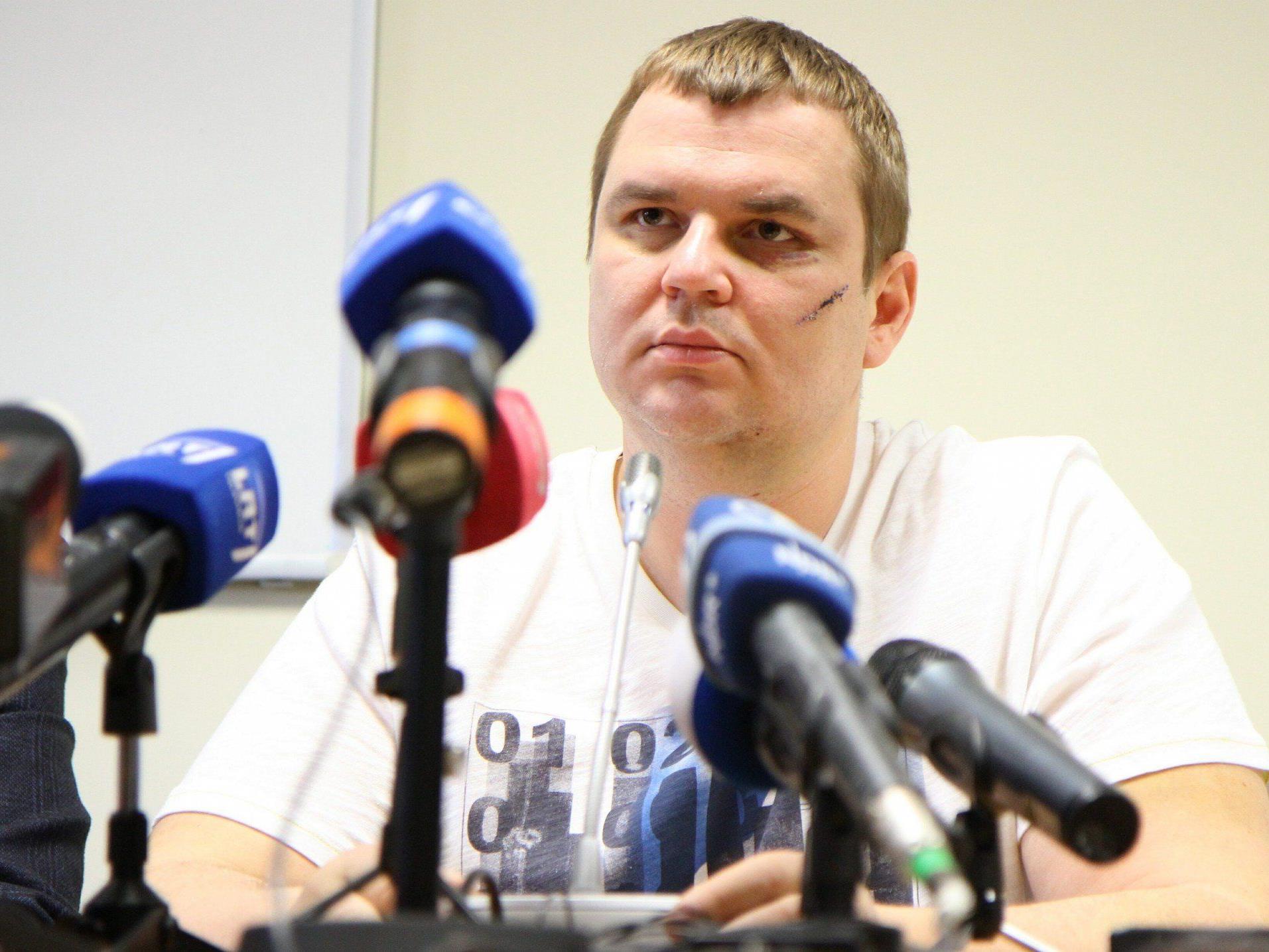 Regierungskritiker erhebt Vorwürfe gegen "russischsprachige Folterer".