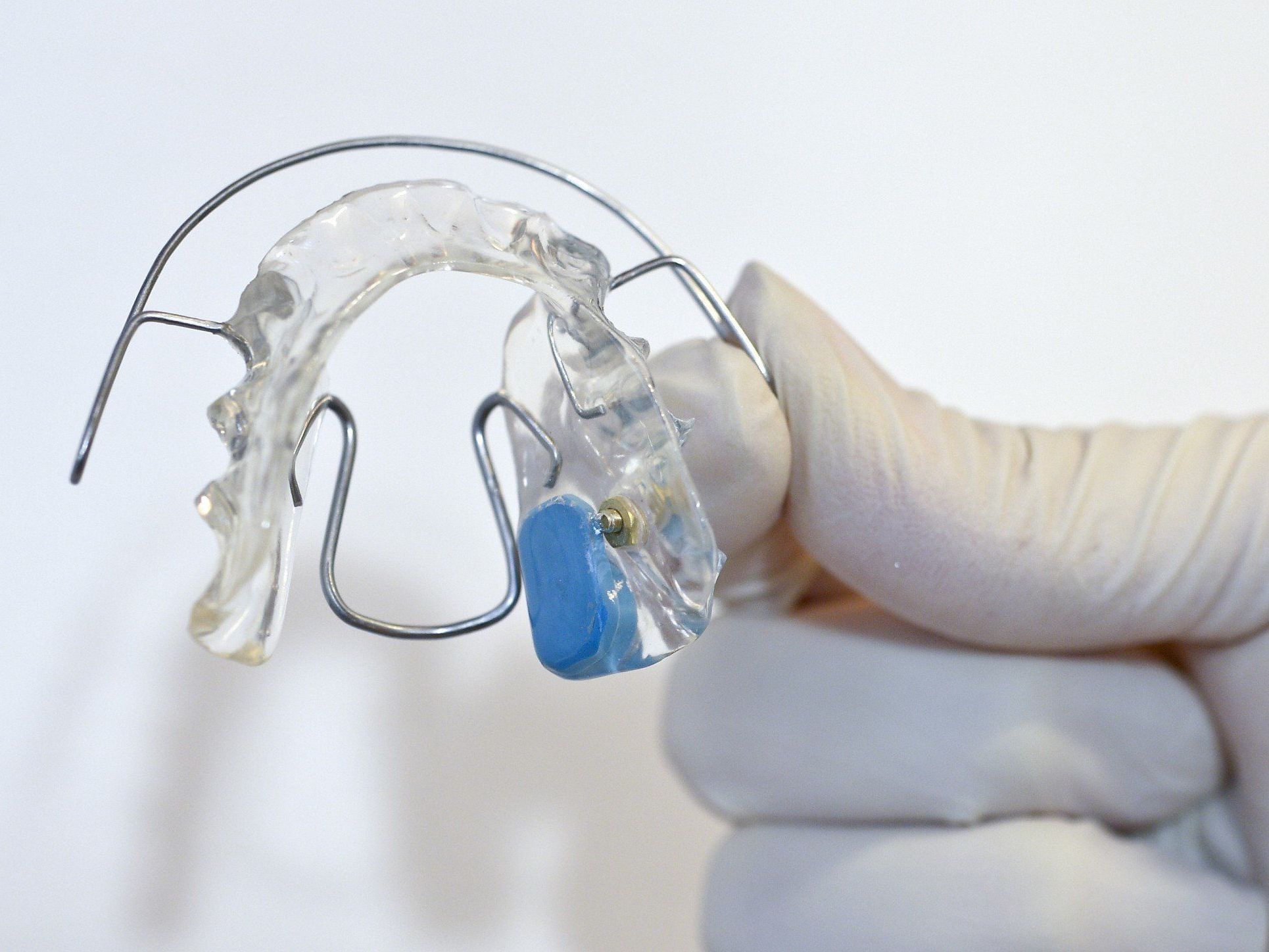 Kinder bis 18 Jahre sollen künftig kostenlose Zahnspangen erhalten. Kinder bis 18 Jahre sollen künftig kostenlose Zahnspangen erhalten.