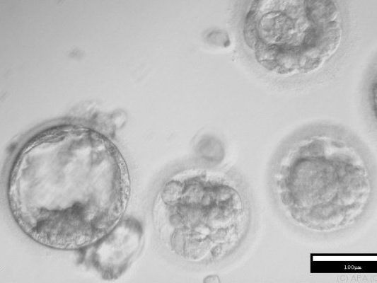 Stammzellen mit embryo-ähnlichen Eigenschaften Stammzellen mit embryo-ähnlichen Eigenschaften