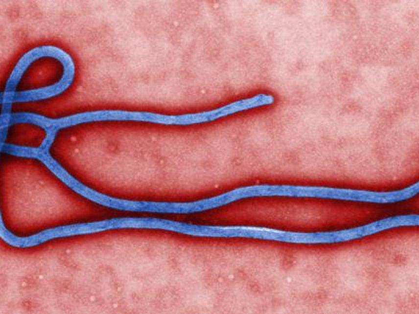 Das Ebola-Virus wird über direkten Kontakt mit Blut oder Körperflüssigkeiten (Speichel, Urin) von Infizierten übertragen.