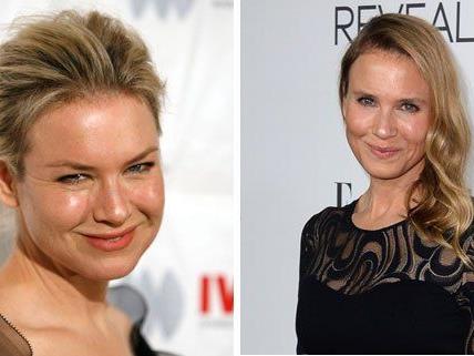 Wenn Stars dem Beautywahn verfallen, muss das nicht immer gut ausgehen. Wenn Stars dem Beautywahn verfallen, muss das nicht immer gut ausgehen.