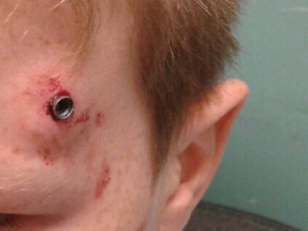 Ein Junge wurde am Rand eines Fußballplatzes von einer Kugel in den Kopf getroffen.