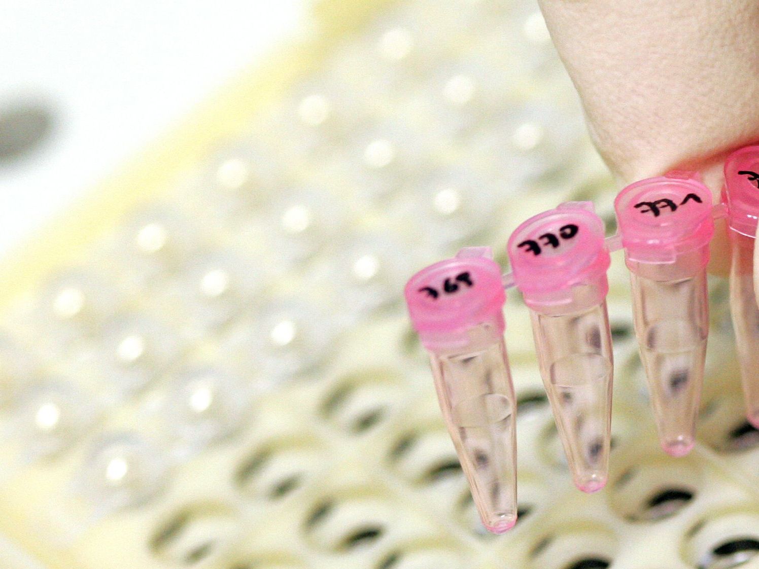 Woher der Erreger kommt, war vorerst unklar und ist noch Gegenstand von Untersuchungen. Woher der Erreger kommt, war vorerst unklar und ist noch Gegenstand von Untersuchungen.