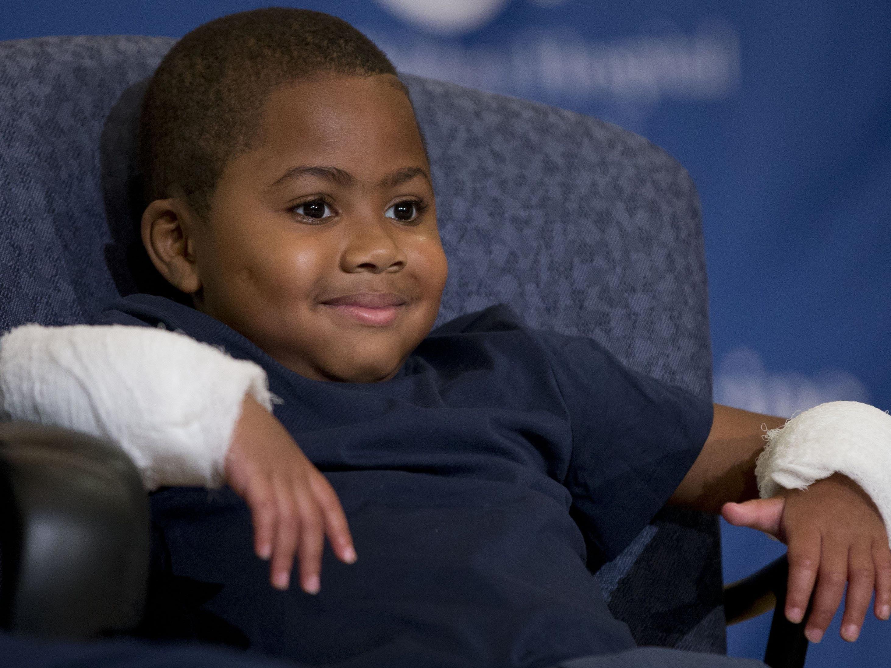 Zion Harvey erhielt in den USA als erstes Kind zwei Spender-Hände.