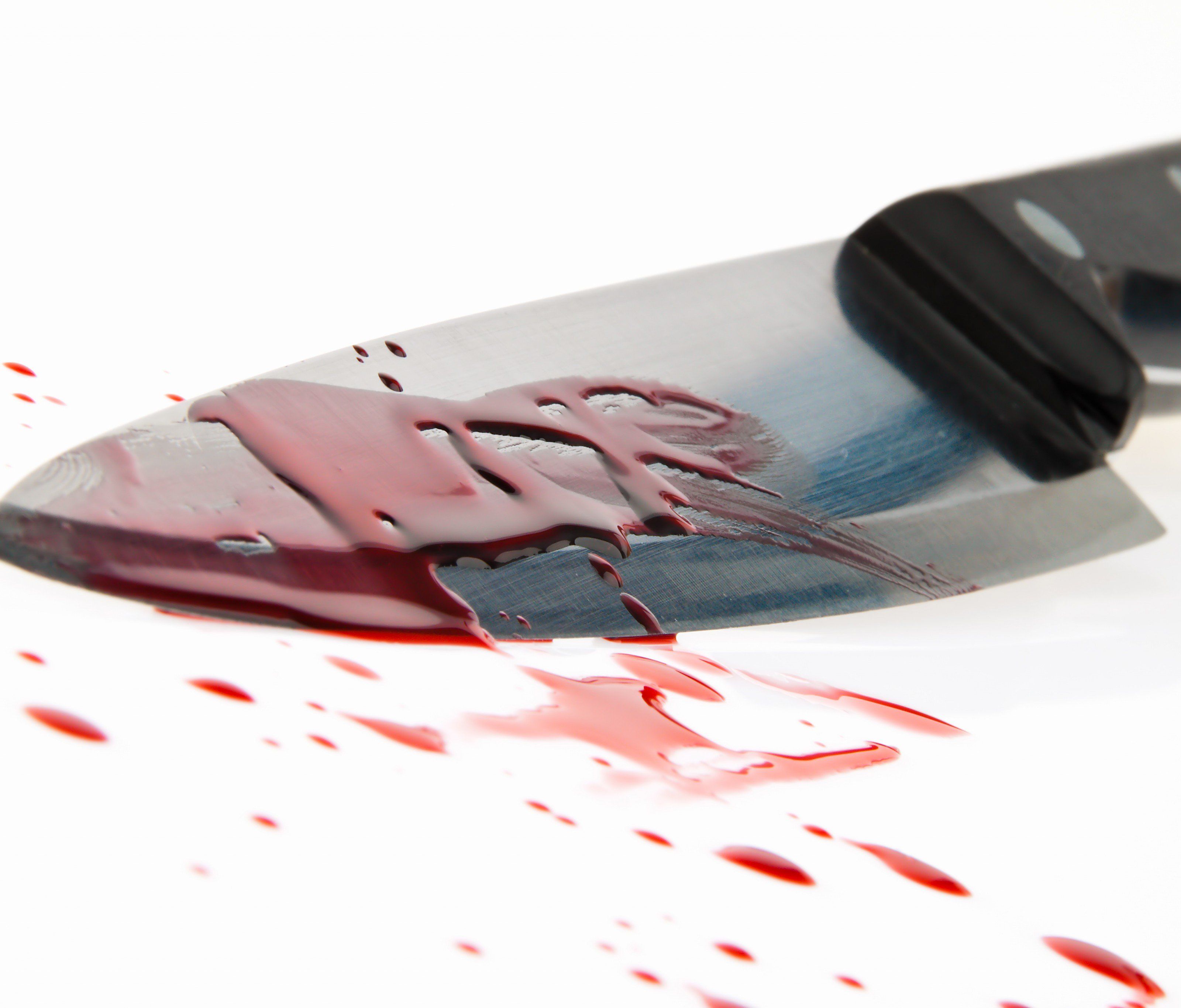 Der 37-Jährige greift direkt in das Messer. Der 37-Jährige greift direkt in das Messer.