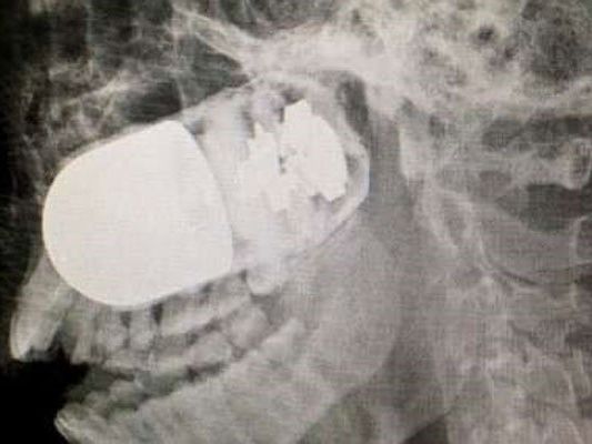 Improvisierter Operationssaal auf Parkplatz wegen Explosionsgefahr. Improvisierter Operationssaal auf Parkplatz wegen Explosionsgefahr.