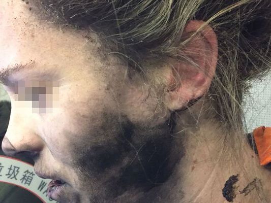 Die Kopfhörer explodierten während sie schlief Die Kopfhörer explodierten während sie schlief